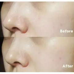 Тонер для сужения пор Etude House Wonder Pore Freshner, 250 мл, изображение 2