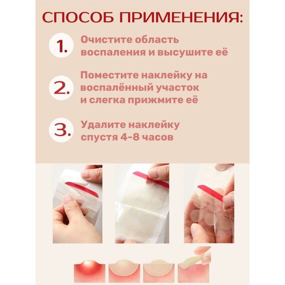 Наклейки против прыщей Elizavecca Witch Piggy Hell-Pore Blemish Spot Patch, 44 шт\уп, изображение 9