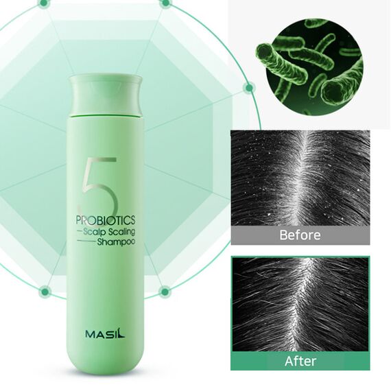 Глубокоочищающий шампунь с пробиотиками Masil 5 Probiotics Scalp Scaling Shampoo, 20 шт\уп по 8 мл, изображение 3
