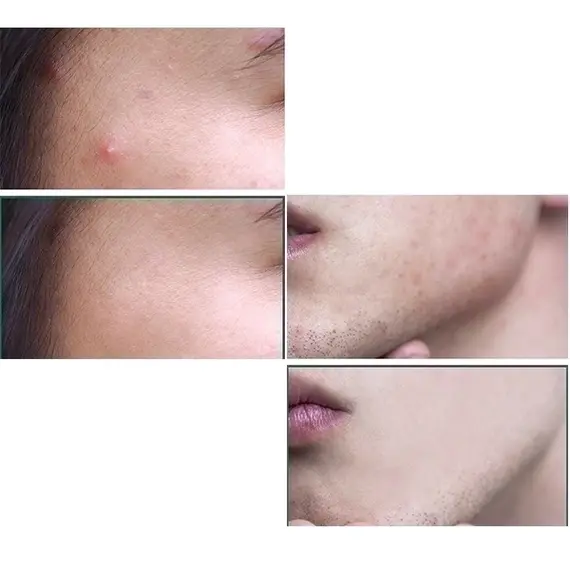 Кислотная сыворотка для проблемной кожи Some By Mi AHA BHA PHA 30 Days Miracle Serum, 50 мл, изображение 9