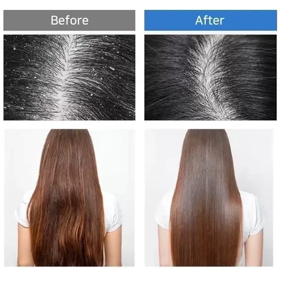 Шампунь для объема волос с пробиотиками Masil 5 Probiotics Perfect Volume Shampoo, 150 мл, изображение 6